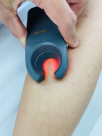 escleroterapia tratamiento arañitas medellin